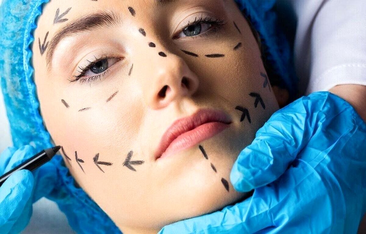 هشدار جدی یک پزشک: بحران عظیم ژل فلهای تقلبی روی صورت مردم!