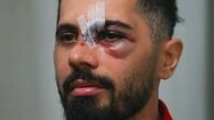 روی دیگر فوتبالیست بودن؛ بازیکنان نان در خون خود می‌زنند!