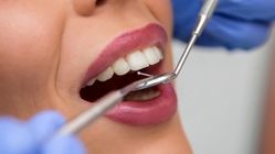 پر مصرف ترین مواد دندانپزشکی که باید بشناسید