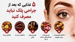 ۵ غذایی که بعد از جراحی پلک نباید مصرف کنید