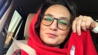 عکس | چین‌وچروک‌های شیرین روی صورت بازیگر زن مشهور