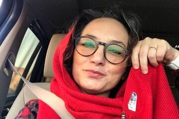 عکس | چینوچروکهای شیرین روی صورت بازیگر زن مشهور